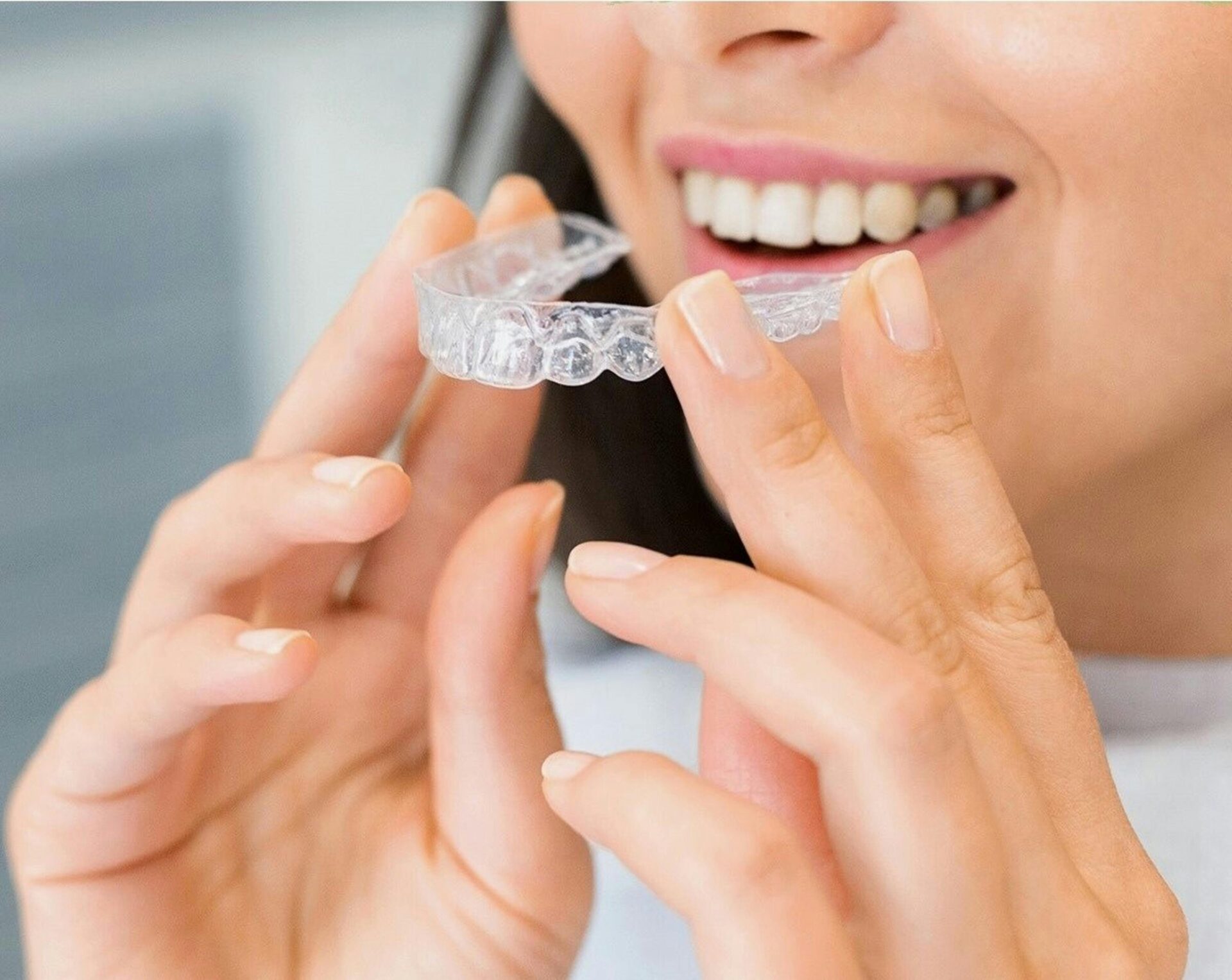 Damon Braces: How to Reduce Orthodontic Treatment Time by up to 12 Months